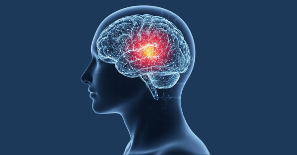 Brain Mapping for Concussions: A Guide for Injury Clients